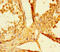 SMAD Family Member 5 antibody, CSB-PA859108LA01HU, Cusabio, Immunohistochemistry frozen image 