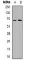 TATA-Box Binding Protein Associated Factor 15 antibody, orb318787, Biorbyt, Western Blot image 