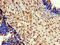 Eukaryotic Elongation Factor 2 Kinase antibody, LS-C396342, Lifespan Biosciences, Immunohistochemistry paraffin image 