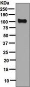 Folate Hydrolase 1 antibody, ab133579, Abcam, Western Blot image 