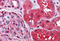 Radixin antibody, MBS242890, MyBioSource, Immunohistochemistry frozen image 