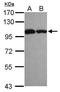 Activating Signal Cointegrator 1 Complex Subunit 2 antibody, GTX116950, GeneTex, Western Blot image 