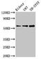 Potassium Voltage-Gated Channel Subfamily A Member Regulatory Beta Subunit 1 antibody, CSB-PA012013LA01HU, Cusabio, Western Blot image 