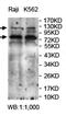 Phosphatidylinositol-4,5-Bisphosphate 3-Kinase Catalytic Subunit Beta antibody, orb78097, Biorbyt, Western Blot image 