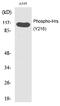 Hepatocyte Growth Factor-Regulated Tyrosine Kinase Substrate antibody, PA5-40200, Invitrogen Antibodies, Western Blot image 
