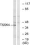 Testis Specific Serine Kinase 4 antibody, TA316307, Origene, Western Blot image 