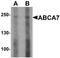 ATP Binding Cassette Subfamily A Member 7 antibody, TA319812, Origene, Western Blot image 