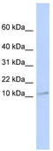 ER Membrane Protein Complex Subunit 6 antibody, TA335434, Origene, Western Blot image 