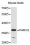 Parvin Gamma antibody, STJ114742, St John