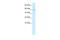 Transmembrane Protein 175 antibody, A11712, Boster Biological Technology, Western Blot image 