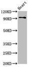 Discs Large MAGUK Scaffold Protein 2 antibody, CSB-PA621882LA01HU, Cusabio, Western Blot image 