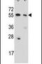 Copine 8 antibody, PA5-25255, Invitrogen Antibodies, Western Blot image 