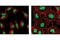 SUZ12 Polycomb Repressive Complex 2 Subunit antibody, 3737S, Cell Signaling Technology, Immunocytochemistry image 