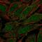 Zinc Finger Protein 510 antibody, NBP2-13578, Novus Biologicals, Immunofluorescence image 