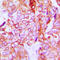 Erb-B2 Receptor Tyrosine Kinase 3 antibody, LS-C356018, Lifespan Biosciences, Immunohistochemistry paraffin image 