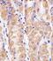 Thioredoxin antibody, A01219, Boster Biological Technology, Immunohistochemistry paraffin image 