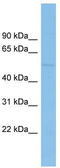 BEN Domain Containing 7 antibody, TA329785, Origene, Western Blot image 