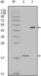 Baculoviral IAP Repeat Containing 5 antibody, 32-222, ProSci, Western Blot image 