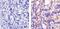 Erb-B2 Receptor Tyrosine Kinase 4 antibody, GTX80811, GeneTex, Immunohistochemistry paraffin image 