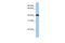 FtsJ RNA 2'-O-Methyltransferase 1 antibody, 30-509, ProSci, Western Blot image 