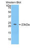 Interleukin 17 Receptor B antibody, LS-C294854, Lifespan Biosciences, Western Blot image 