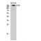 CF Transmembrane Conductance Regulator antibody, LS-B14474, Lifespan Biosciences, Western Blot image 