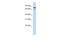 RecQ Mediated Genome Instability 1 antibody, A03930, Boster Biological Technology, Western Blot image 