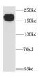 CD109 antigen antibody, FNab01408, FineTest, Western Blot image 