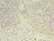 Dehydrogenase/Reductase 12 antibody, CSB-PA006857LA01HU, Cusabio, Immunohistochemistry frozen image 