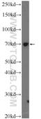 NFKB Inhibitor Zeta antibody, 14014-1-AP, Proteintech Group, Western Blot image 