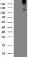 Transforming Growth Factor Beta Receptor 3 antibody, TA809350S, Origene, Western Blot image 