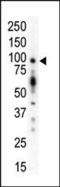 Protein Kinase D1 antibody, PA5-13749, Invitrogen Antibodies, Western Blot image 