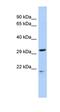 Uncharacterized protein C10orf12 antibody, orb325976, Biorbyt, Western Blot image 