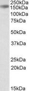 Drosha Ribonuclease III antibody, GTX89198, GeneTex, Western Blot image 