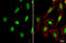 Heterogeneous Nuclear Ribonucleoprotein L antibody, GTX132760, GeneTex, Immunofluorescence image 