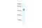 Keratin 15 antibody, 30-995, ProSci, Western Blot image 