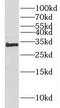 Homeobox protein Hox-C8 antibody, FNab03983, FineTest, Western Blot image 