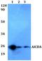 Activation Induced Cytidine Deaminase antibody, GTX66775, GeneTex, Western Blot image 