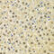 Sphingosine Kinase 1 antibody, 13-049, ProSci, Immunohistochemistry paraffin image 