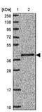 Pre-MRNA Processing Factor 18 antibody, NBP2-46757, Novus Biologicals, Western Blot image 