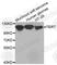 Telomerase Reverse Transcriptase antibody, A2979, ABclonal Technology, Western Blot image 