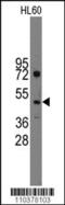 IHH antibody, 61-433, ProSci, Western Blot image 