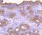 Ectonucleoside Triphosphate Diphosphohydrolase 1 antibody, NBP2-67230, Novus Biologicals, Immunohistochemistry paraffin image 