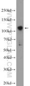 Zinc Finger Protein 711 antibody, 25166-1-AP, Proteintech Group, Western Blot image 