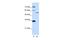 Zinc Finger Protein 707 antibody, A15522, Boster Biological Technology, Western Blot image 