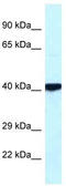 cAMP-dependent protein kinase catalytic subunit beta antibody, TA337696, Origene, Western Blot image 