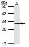 Proteasome Subunit Beta 4 antibody, GTX101780, GeneTex, Western Blot image 
