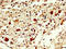 Exosome Component 10 antibody, LS-C669758, Lifespan Biosciences, Immunohistochemistry paraffin image 