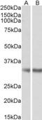 Monoglyceride Lipase antibody, NB100-96920, Novus Biologicals, Western Blot image 