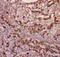 CD11b antibody, LS-C344008, Lifespan Biosciences, Immunohistochemistry paraffin image 